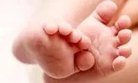 به دنیا آوردن دوقلو در داخل پرده آمنیوتیک