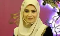 تغییر چهره شدید صبا راد که توی ذوق زد