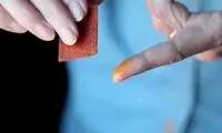 تفاوت بتادین و ید چیست و چه کاربردهایی دارند؟