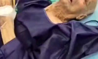 فیلم سیگار کشیدن پیرمرد ۹۶ساله‌ ایرانی در اتاق عمل!
