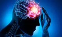 آنچه باید درباره صرع بدانید