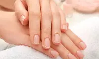 دلیل وجود لکه­‌هاى سفید (لوکونیشیا) روى ناخن­‌هایمان چیست؟