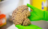 آهسته شدن پیری مغز با خون بند ناف