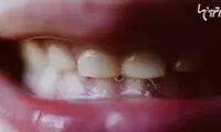 حقایقی درباره دهان که نمی‌دانستید