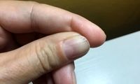 هشدار جدی پزشکان درباره ژل ناخن به خانم‌ها
