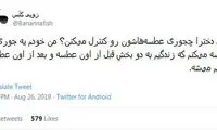 شوخی‌های جالب شبکه‌های اجتماعی؛ درمان خانگی اتوسوختگی!