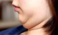 چگونه غبغب را از بین ببریم؟