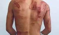وضعیت یک عکاس پس از آزادی از بازداشت طالبان