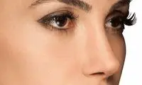 جراحی نوک بینی چگونه است؟