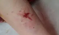 حمله سگ‌های ولگرد به یک خانم در لواسان