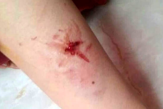 حمله سگ‌های ولگرد به یک خانم در لواسان