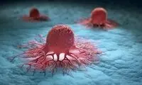 علائمی که می‌تواند به سرطان اشاره داشته باشد