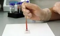 آزمایش خون عجیبی که تاریخ مرگ را می‌گوید!
