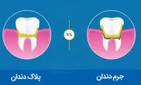 روش‌های سنتی جِرم‌گیریِ دندان در خانه