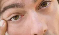 با خشکی چشم چه میشه کرد؟