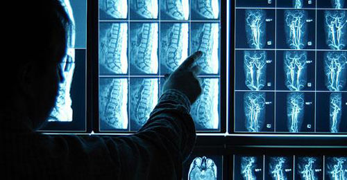 علم رادیولوژی؛ از اشعه ایکس تا امواج مغناطیس