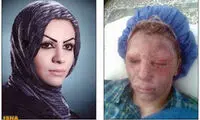 «معصومه» از قصاص پدرشوهرش گذشت