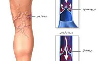 10 فرمان واریس