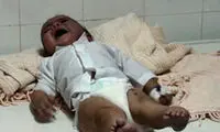 شکنجه نوزاد 6 ماهه در دخمه معتادان +عکس