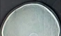 تصویر یک مداد در داخل مغز کودک 2 ساله!