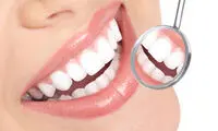 بهترین دکتر لمینت دندان در تهران کیست؟ + معرفی 10 دکتر برتر