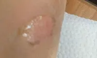 حادثه هولناک برای دانش‌آموز ۹ ساله
