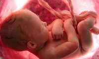 با 9 نقش اصلی کیسه آب جنین آشنا شوید