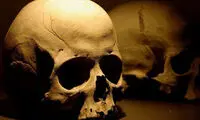 امکان ترمیم سریع ضایعات استخوانی