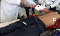قطع دست جوان هنگام کار با پوست کن پسته