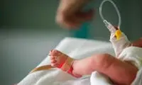 انقلاب علمی در جراحی قلب باز نوزادان