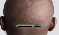 ساخت پروتز کاشتنی در مغز برای تقویت هوش