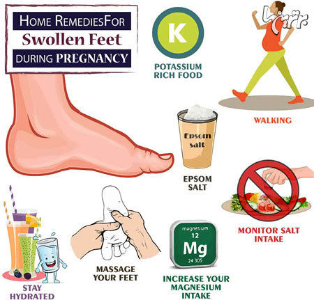 درمان خانگی تورم پا‌ها در دوران بارداری