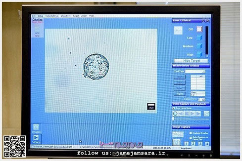 مرکز اهدای تخمک و جنین +عکس