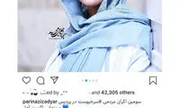 پاسخ پریناز ایزدیار به واکنش‌ها درباره تغییر چهره‌اش