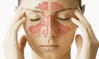 چه کسانی بیشتر به سینوزیت مبتلا می شوند؟