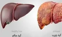 خواص بی‌نظیر این میوه برای کبد چرب