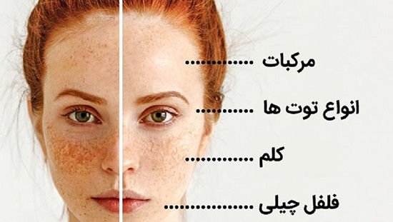 با این خوراکی ها، مشکلات پوستی را برطرف کنید