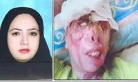 عکس مادر و دختر قربانی اسیدپاشی