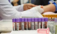 آقایان! سطح ویتامین D خود را چک کنید!