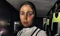 واکنش سهیلا منصوریان به پست تند کوچک‌زاده