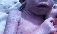 عکس: تولد دختری عجیب در هند! (18+)