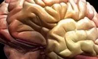 مغز هم نیاز به استراحت دارد
