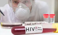 زنان HIV، قربانی همسران!