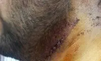 ضرب و شتم بسیجیان ناهی از منکر +عکس