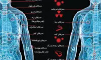 بدشانسی شما را گرفتار کدام سرطان‌ میکند؟