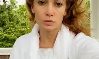 جنیفر از نقش ژنتیک در سلامت پوستش می‌گوید!